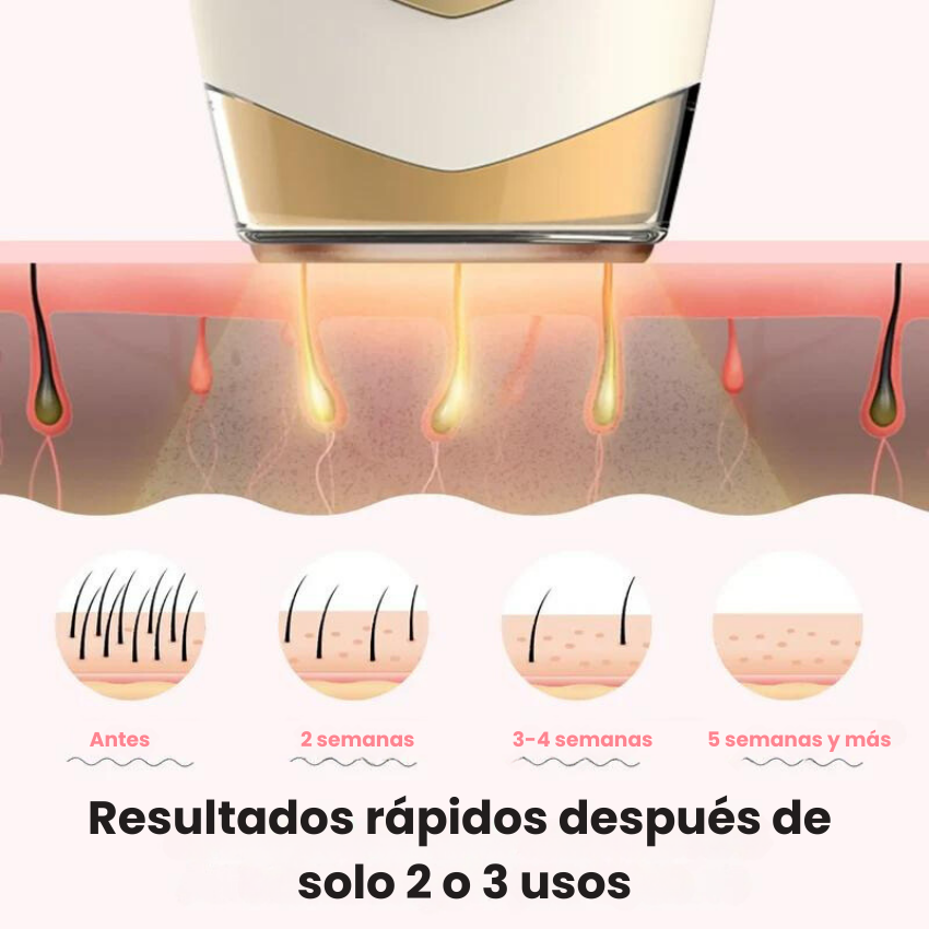 LUMINA IPL PRO